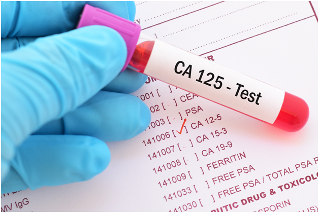 Screening test for ovarian cancer