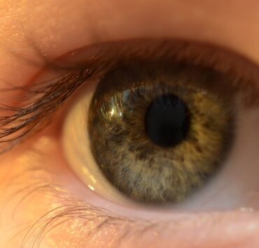 contact lens