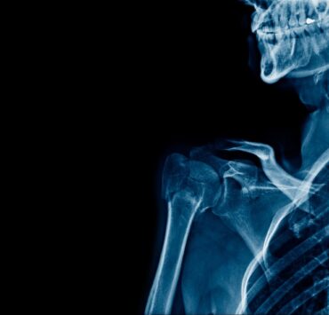Why get a lawyer if theres medical malpractice