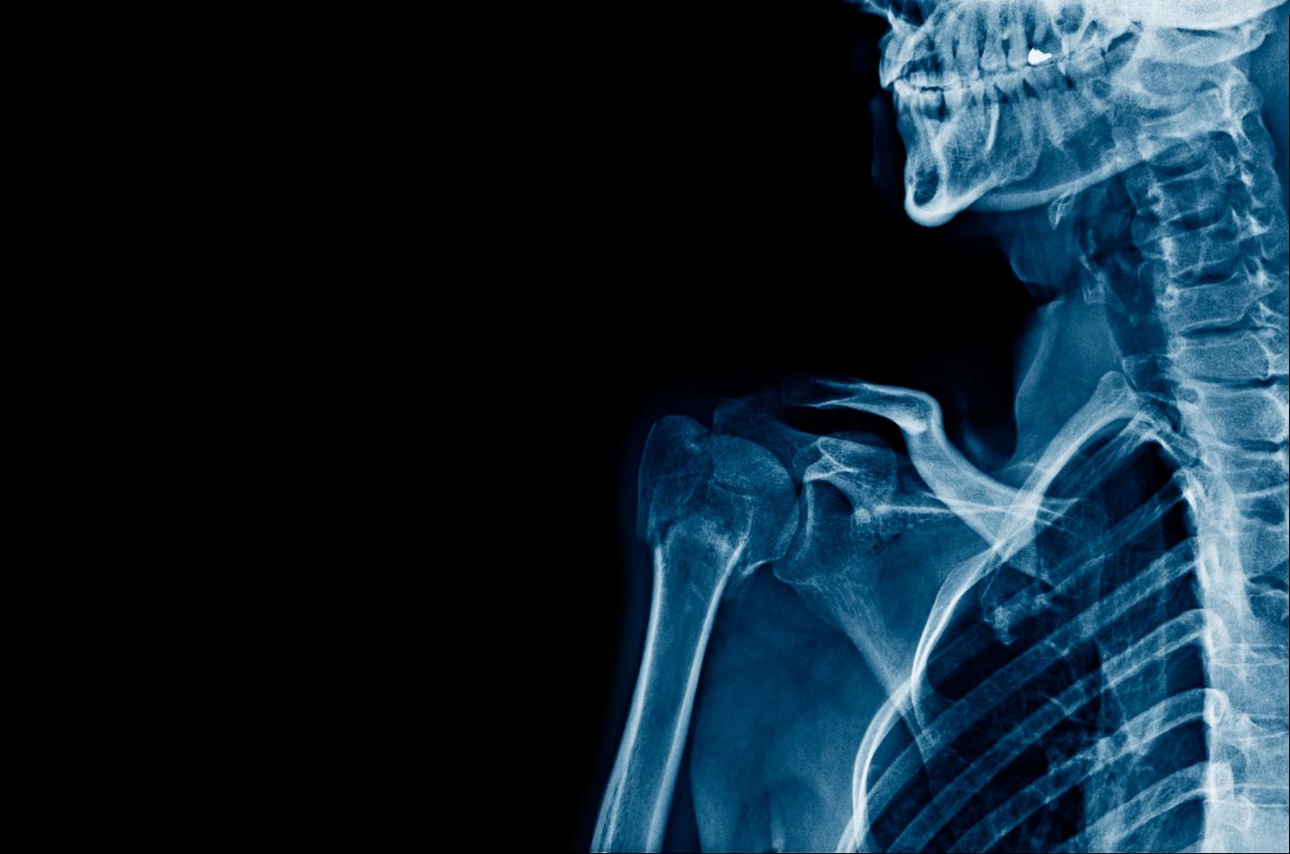Why get a lawyer if theres medical malpractice